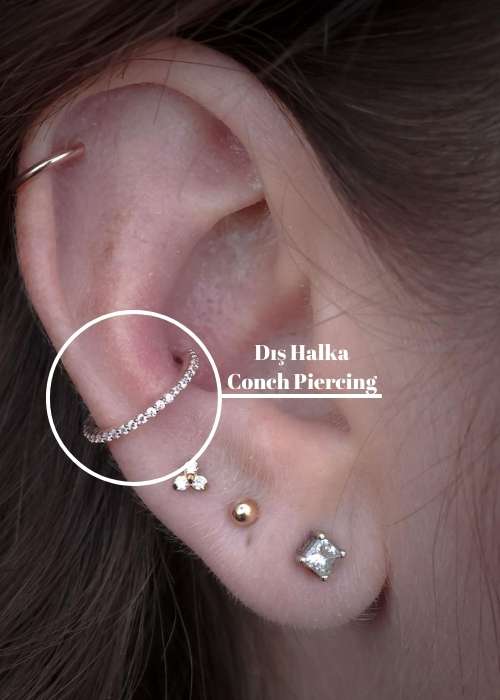 Dış Halka Conch Piercing