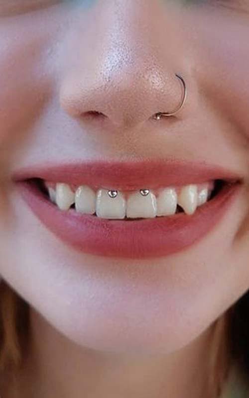 Smiley Piercing Bakımı